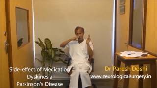 Dyskinesia in Parkinsons Disease [upl. by Aihsenal]