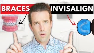 Braces vs Invisalign  How to choose between the two [upl. by Violet]