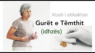 GURET NE TEMTH idhëz  Ushqimet qe nuk lejohen  Si sherohen guret e temthit  idhzes  Biliare [upl. by Eisso]