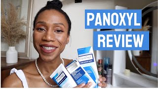 PanOxyl Acne Foaming Wash Overnight Spot Patches and Oil Control Moisturizer Review  Regina Ramos [upl. by Tsew]