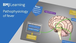 Pathophysiology of fever explained [upl. by Ilrahs493]