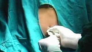 Lumbar Puncture [upl. by Toni]