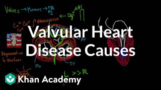 Valvular heart disease causes  Circulatory System and Disease  NCLEXRN  Khan Academy [upl. by Tnahs]