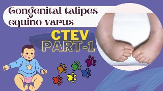 CONGENITAL TALIPES EQUINO VARUS  PART1  CLUB FOOT  CTEV  PATHOANATOMY amp TREATMENT OF CTEV [upl. by Parnas]