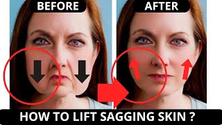 🛑 LIFT SAGGING SKIN EXERCISE JOWLS NASOLABIAL FOLDS  FACELIFT FOREHEAD LINES ANTIAGING CHEST [upl. by Bakerman]