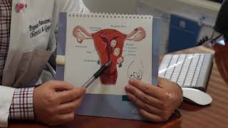 The different types uterine fibroids [upl. by Sayer586]