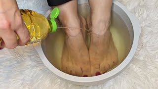 I soaked my feet in APPLE CIDER VINEGAR and 15 minutes later I was shocked at what happened [upl. by Xonel]