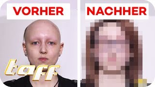 Antonia 19 hat extremen Haarausfall  Kann man ihr helfen SOS  Einsatz der BeautyRetter  taff [upl. by Eilsil]