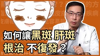 讓黑斑、肝斑根治且不復發的關鍵是？皮膚科林政賢醫師告訴你，如何用矽谷電波進行生態系養膚，打造無斑好膚質！ [upl. by Burleigh]