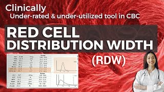 Red cell Distribution Width RDW  What is it and what are its uses [upl. by Roos517]