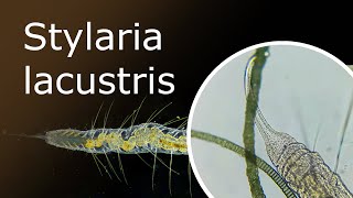 All About Stylaria Lacustris Description and Habitat Stylaria Under a Microscope 100x250x [upl. by Nereus]