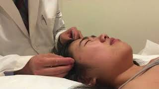 Acupuncture Taiyanghou A needle Unblock Nose 鼻塞太阳后一针即通 [upl. by Kaczer]