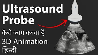 How ultrasound probe works  3D Animation Hindi  Ultrasound Probe कैसे काम करता है [upl. by Lucias]