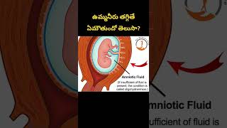 ఉమ్మనీరు తగ్గితే ఏమౌతుందో తెలుసా Low amniotic fluid [upl. by Yasdnil]