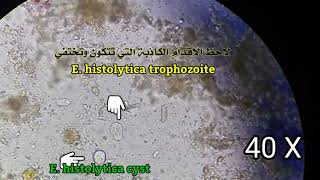 هل شاهدت Ehistolytica cyst والاقدام الكاذبة في طور ال Entamebia histolytica Trophozoite؟؟؟ [upl. by Chatav]