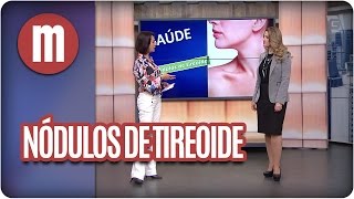 Nódulos de tireoide  Mulheres 25102016 [upl. by Imalda]