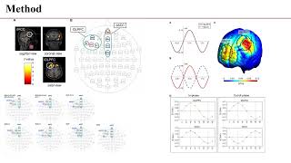 저널 미팅 Neuromodulation of inhibitory control using phaselagged tACS [upl. by Suilmann]