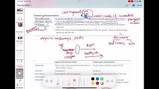 common cranial Nerves lesions neurology 153  First Aid USMLE Step 1 in UrduHindi [upl. by Lemyt962]