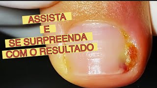 ASSISTA E SE SURPREENDA COM O RESULTADO [upl. by Kiley]