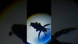 Poux vivant au microscope  sciences microscope poux scary lice [upl. by Martreb]