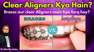 Clear Aligners Invisible Aligners procedure Braces vs clear aligners Invisalign [upl. by Led180]