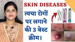 Top 3 Ointments for all Skin Diseases ॥ त्वचा रोगों पर लगाने के बेस्ट 3 क्रीम ॥ [upl. by Roderigo]