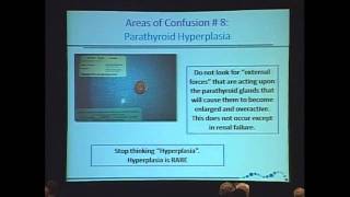 Parathyroid Hyperplasia is Rare Hyperparathyroidism Diagnosis and Treatment [upl. by Naval863]