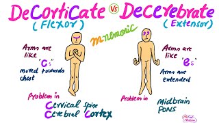 Decorticate Vs Decerebrate RigidityMnemonic for USMLE [upl. by Yesnikcm992]