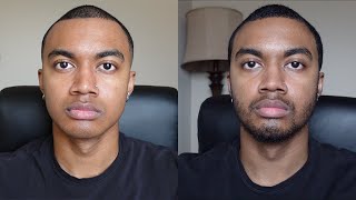 One Year Beard Growth TimeLapse [upl. by Mauve566]