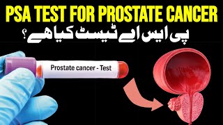 HBV DNA Quantitative RT PCR Test क्यों कराते हैं । HBV viral load।। HBV result interpretation [upl. by Iluj776]