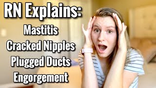 RNSymptoms of Mastitis Engorgement Plugged Milk Ducts Cracked NipplesTreatment  Problem Pt 2 [upl. by Lachish]