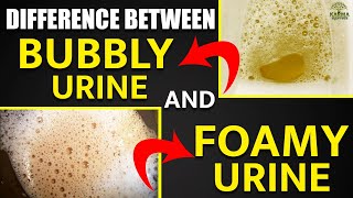 shorts Difference Between Bubbly Urine and Foamy Urine  Karma Ayurveda Reviews  Kidney Expert USA [upl. by Delogu590]