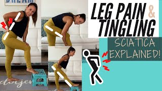 Leg Pain and Tingling  Sciatica Explained [upl. by Neersin318]