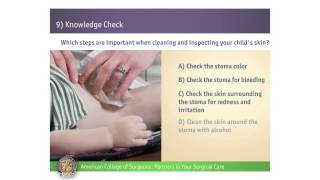 Pediatric Urostomy Knowledge Check [upl. by Elylrac440]