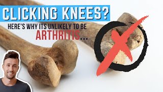 What Is That Cracking Sound in Your Knee Hint Its NOT Knee Arthritis [upl. by Ajup]