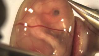 Isolation and injection of an E155 mouse embryo [upl. by Selin371]