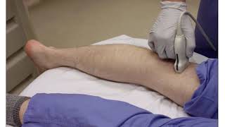 Popliteal Sciatic Nerve Block [upl. by Anivle]