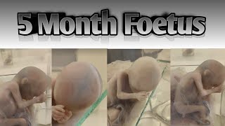 5 month foetus  The Second Trimester Your Babys Growth and Development in Middle Pregnancy [upl. by Nednerb892]