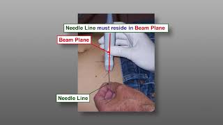 Fine Needle Aspiration Biopsy FNA Techniques  Ultrasound Guided FNA The Parallel Approach [upl. by Croom]