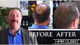 After Hair Transplant With HairCubed Fibers Spray Call 18007191008 [upl. by Einitsed]