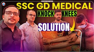 SSC GD Medical 2024 Knock Knees Solution Rojgar With Ankit rojgarwithankit rwa [upl. by Minnnie]