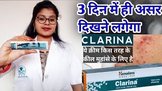 Himalaya Clarina AntiAcne Cream honest reviewClarina AntiAcne Cream benefits uses review inhindi [upl. by Netsruk496]