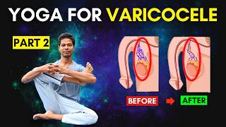 Varicocele Exercises Part 2 At Home  Yoga for Varicocele varicocele [upl. by Nibot]