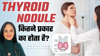 Thyroid Nodule कितने प्रकार का होता है  Thyroid Nodule Treatment  Dr Tanvi Mayur Patel [upl. by Nuahsyt]