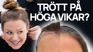 Trött på höga vikar Gör en hårtransplantation [upl. by Bore639]