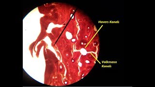 Sıkı Kemik Dokusu Enine Kesit Mikroskop Görüntüleri  Sıkı Kemik Histolojisi [upl. by Sirtaeb296]