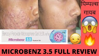 quotMICROBENZ 0035 GEL Review स्पष्ट त्वचा के लिए मुक्ति 🌟👊 ClearSkinMagic GoodbyeAcnequot [upl. by Jacobsen324]