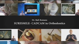 Dr Rafi Romano  Suresmile CADCAM in orthodontics [upl. by Latsyrhk]