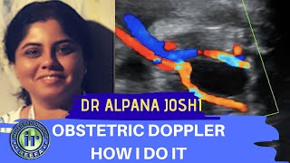 Obstetric Doppler  How I Do It  Dr Alpana Joshi  UMBILICAL ARTERY DOPPLER  MCA PI [upl. by Borchers]