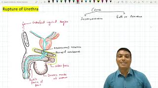 Urethral Rupture [upl. by Meean]